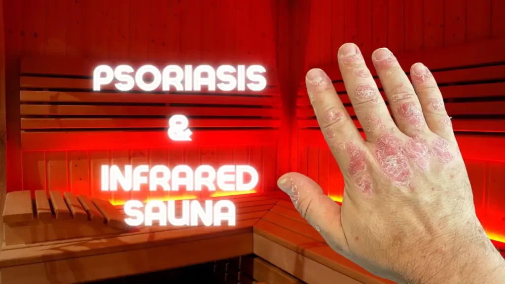 Does Infrared Sauna Help Psoriasis