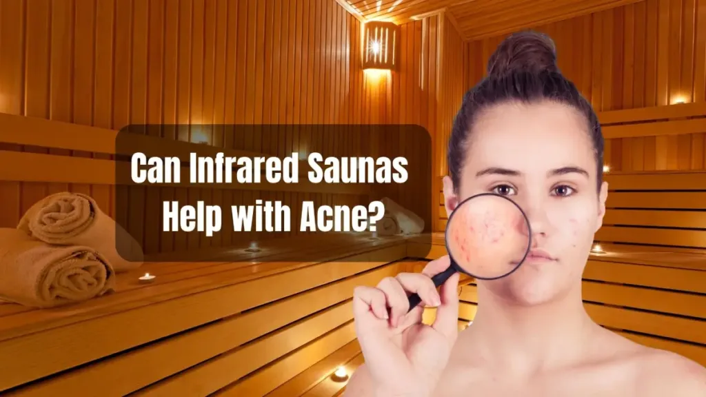 Can Infrared Saunas Help with Acne?